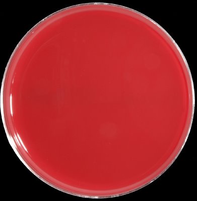 Anaerobic Agar